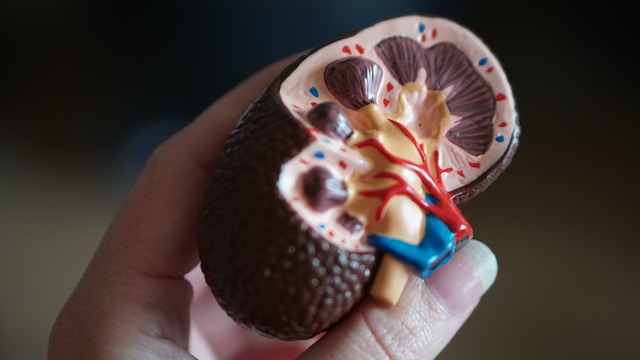 Someone holding a model of a kidney.